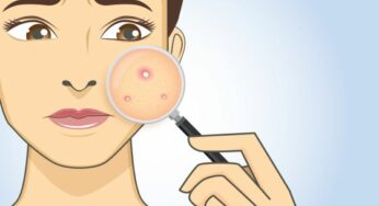 At Home Tips For Controlling Acne Breakouts